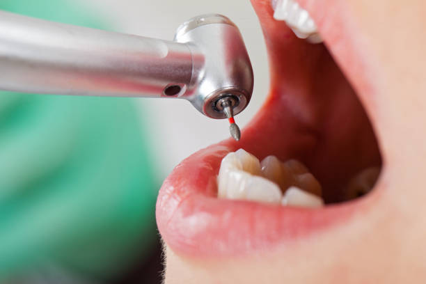 Best Emergency Treatment for Toothache in Pickens, MS